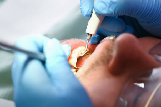 Best Weekend Emergency Dentist in St Petersburg, FL